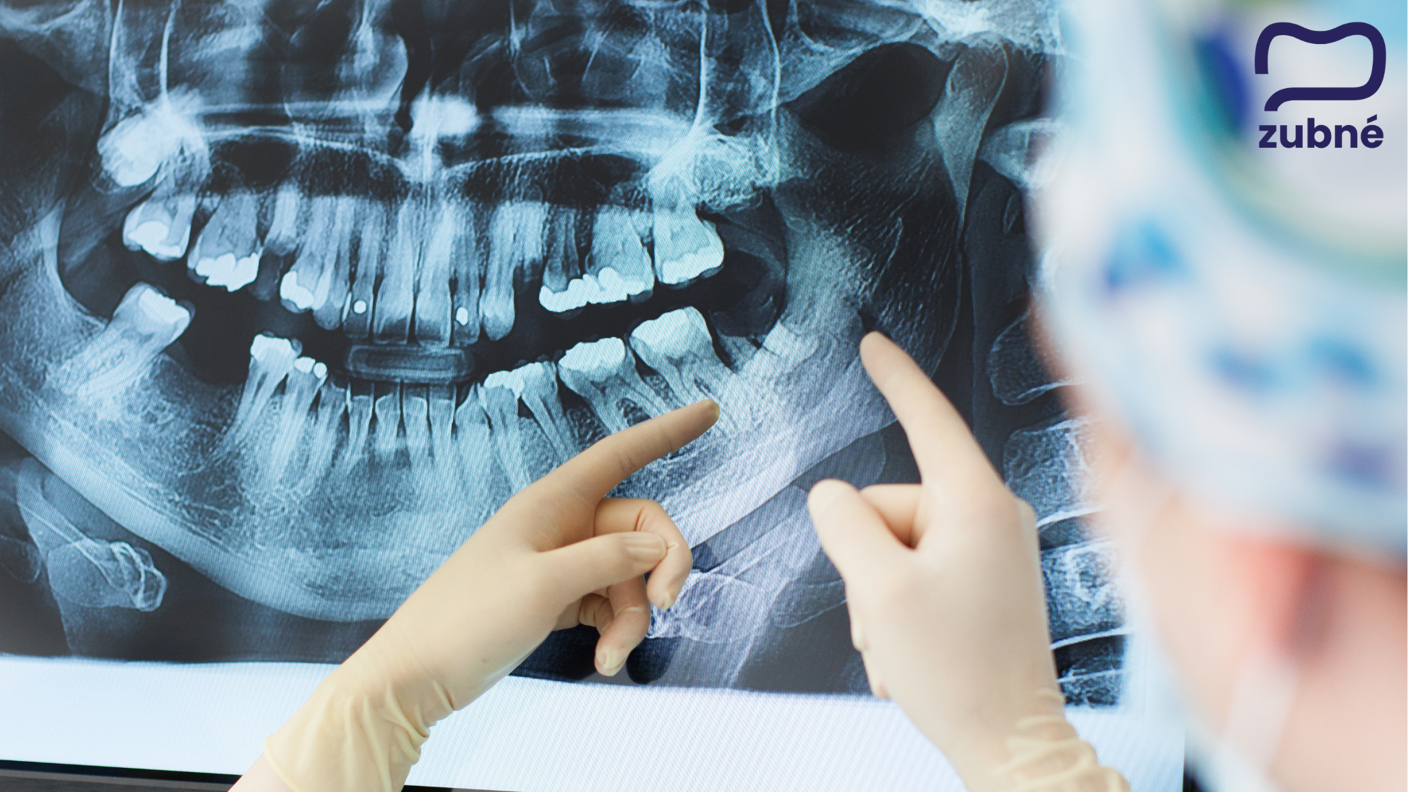 Zubne_RTG